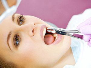 Лечение и удаление зубов 