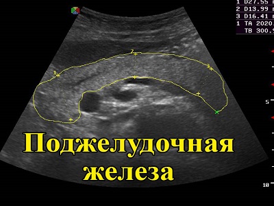 Поджелудочная железа при диабете узи. В результате сонографического осмотра врач получает цифровое изображение, которое определяет основные характеристики поджелудочной железы.